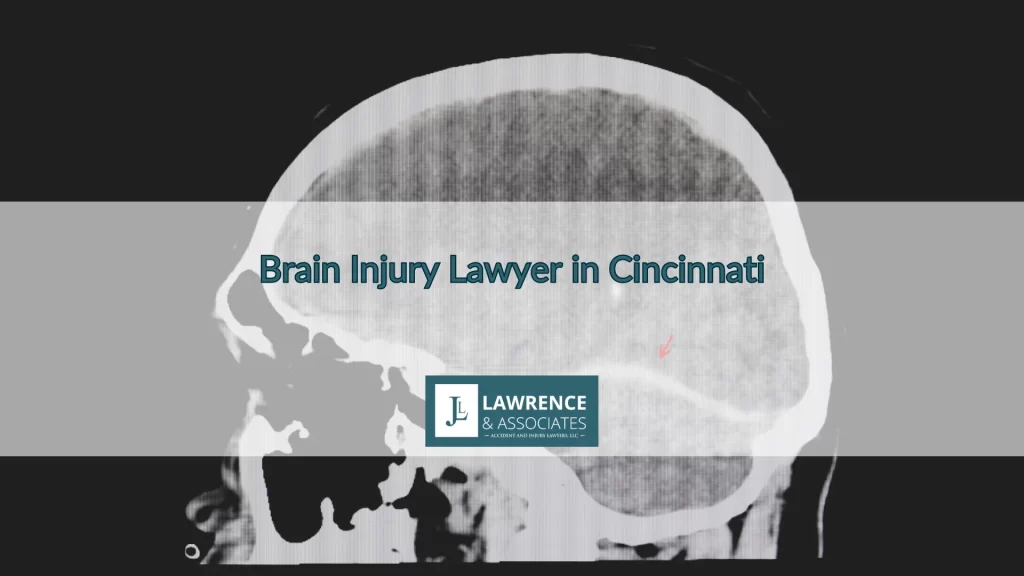 Brain Injury Lawyer in Cincinnati